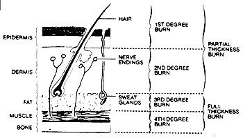 Cross Section of Skin