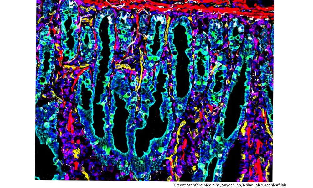Your Intestine Is 20 Feet Long And It Has Neighborhoods