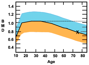 Bone density changes